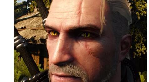 巫师3：狂猎MOD Geralt——减轻脸上的伤疤