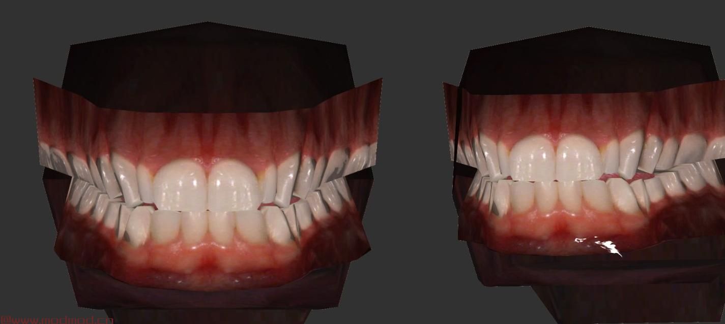 辐射4MOD HN66s和XAZOMNs FO4的独特牙齿