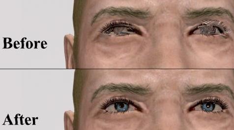 上古卷轴5：重置版MOD 由hhaleyy修复的隐形和眼睛网格